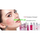 Что такое купероз  и как его лечить?
