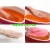 Парафінотерапія